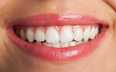 Cosmetic Dentistry